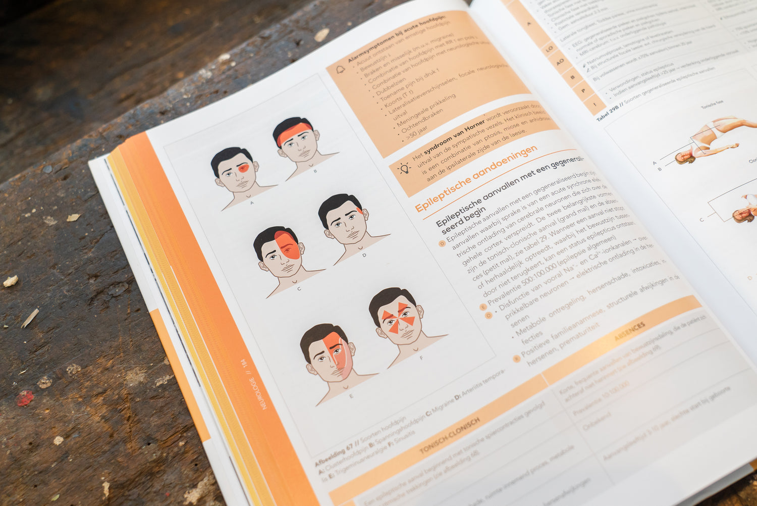 Bladzijde uit de Compendium Geneeskunde boekenreeks met daarop een afbeelding van verschillende soorten hoofdpijn, een kader met alarmsymptomen bij acute hoofdpijn en een weetje over het syndroom van Horner 
