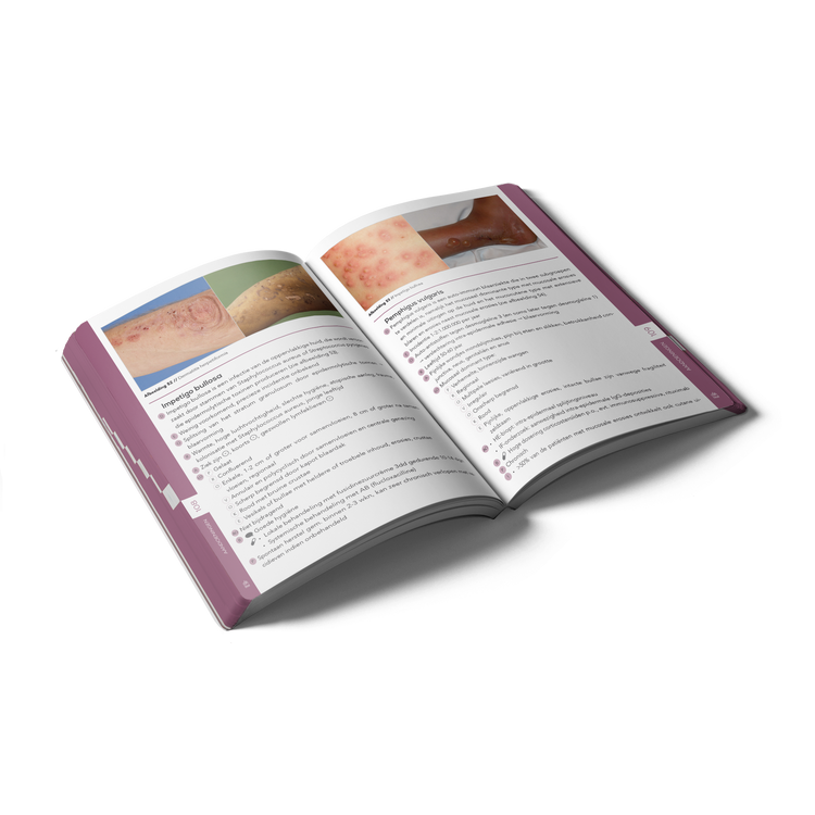 Compendium Geneeskunde pocket Dermatologie inclusieve mockup binnenkant schuin