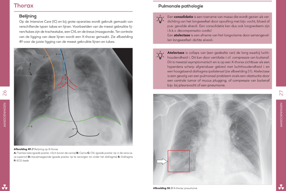 Pocket Radiologie (2024) – Compendium Geneeskunde